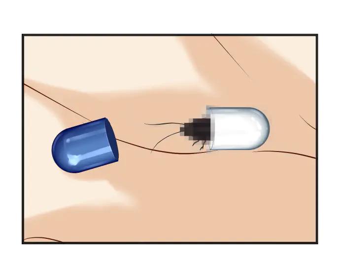 第74页